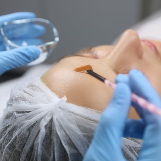 Chemical Peel